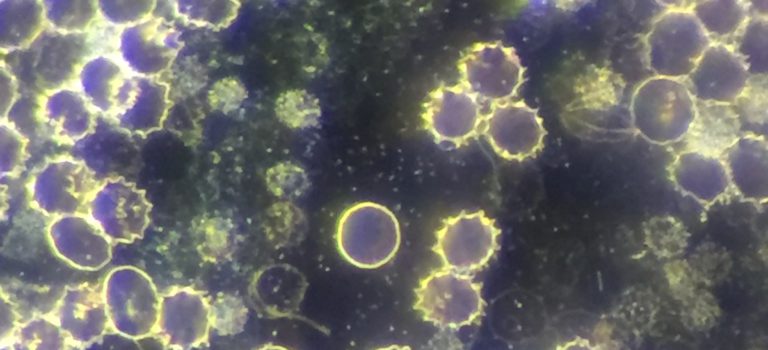CWD- Bakterien ohne Zellwand erkennen und behandeln